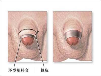中山健民男科医院